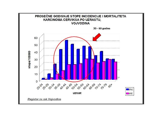 cervix srb